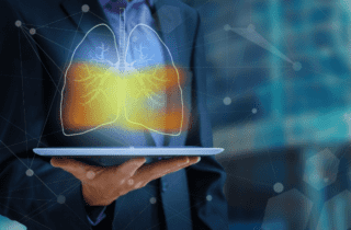 Miracle: l’intelligenza artificiale contro il cancro al polmone