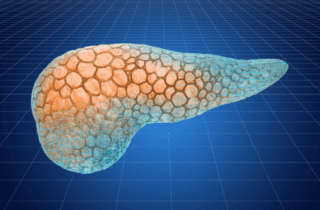 Un pancreas artificiale per il diabete tipo 2