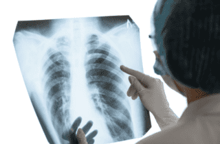 La radiografia ora è a domicilio