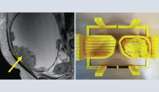 Ovaie 3d foto Ovaie 3d foto