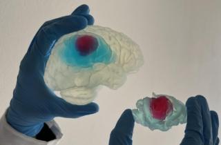 L’intervento al cervello è più preciso e rapido con la riproduzione 3D